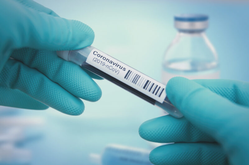 Onkoloji xəstələrin koronavirusdan qorunması üçün tövsiyələr açıqlanıb