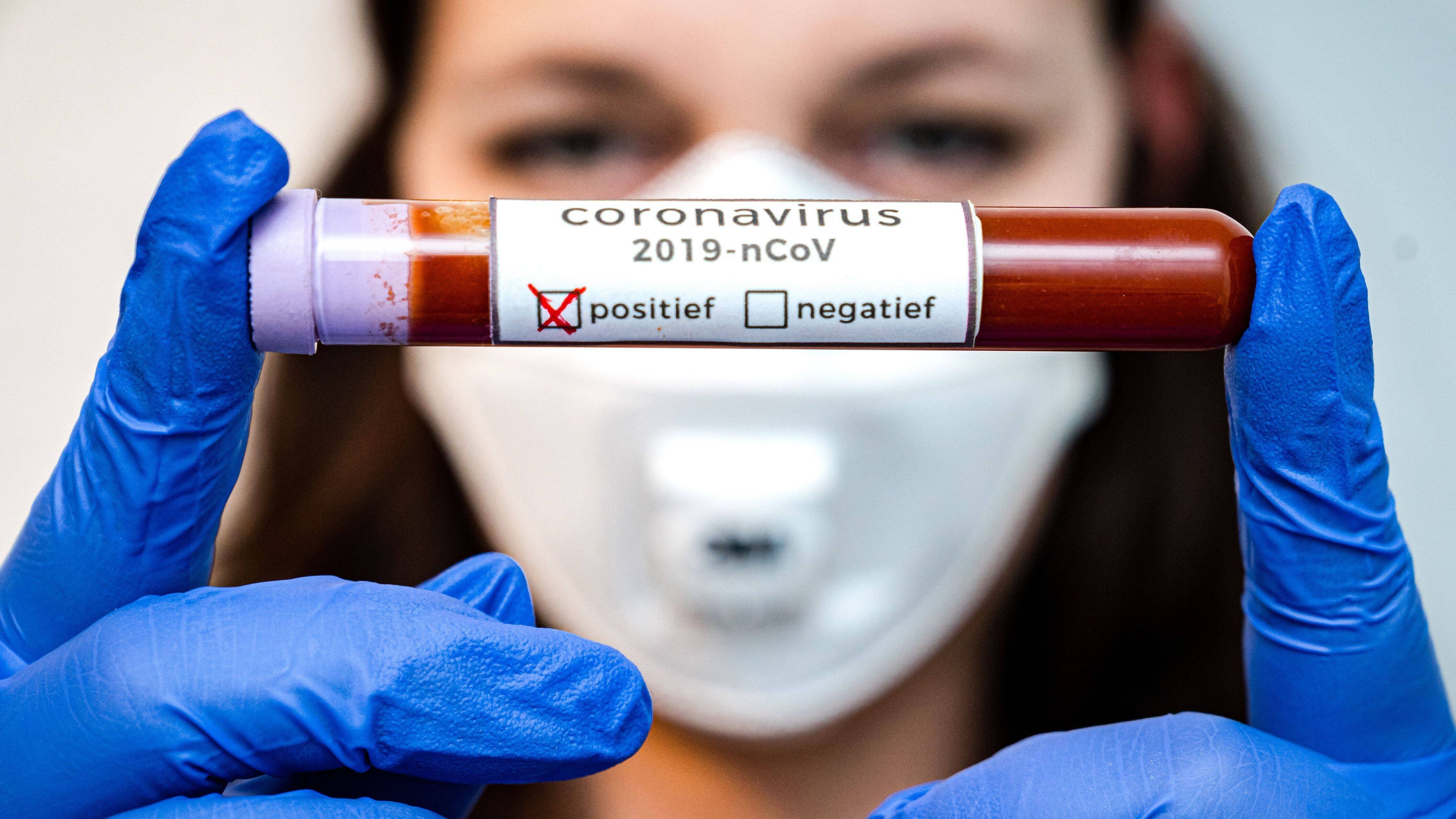 Naxçıvanda 71 nəfərdə koronavirus aşkarlanıb