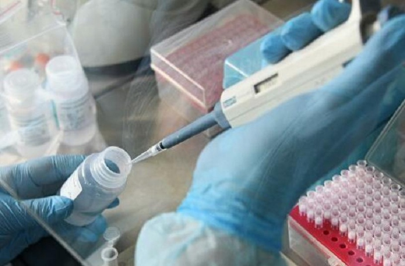 Deputatların koronavirus testinin nəticələri açıqlandı