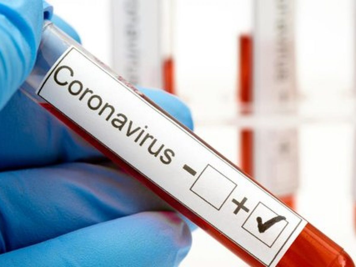 Türkiyədə yeni növ koronavirus infeksiyasından daha 18 nəfər ölüb - VİDEO
