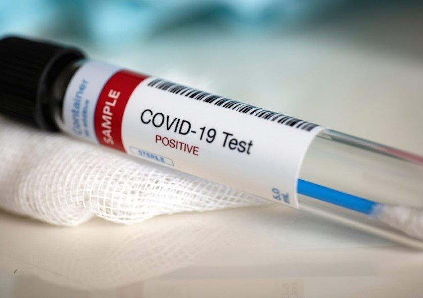 Azərbaycanda daha 122 nəfər koronavirusa yoluxub - Ölən olmayıb