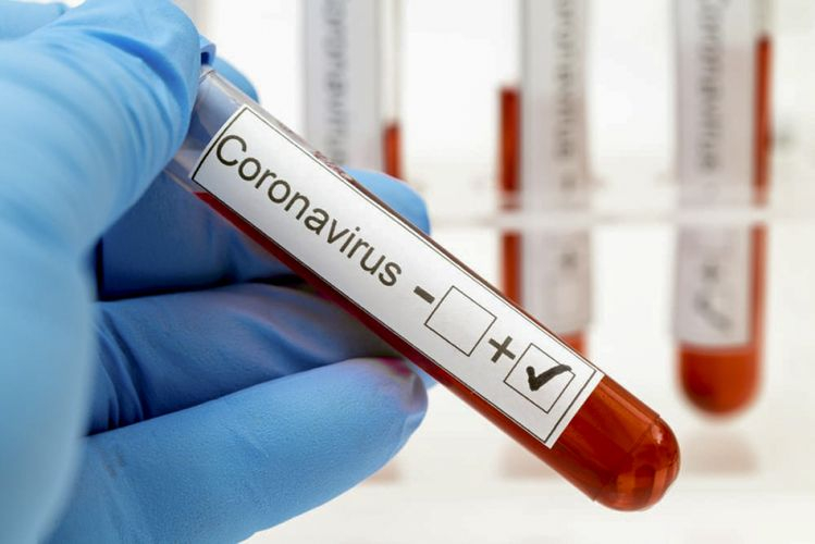 Azərbaycanda son sutkada koronavirusa yoluxma kəskin artdı