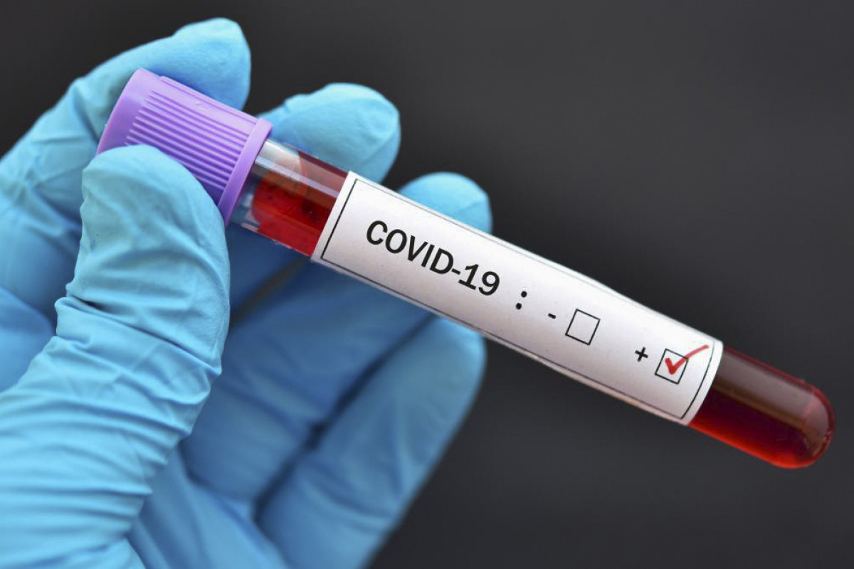 Rusiyada son sutka ərzində koronavirusdan 734 nəfər ölüb