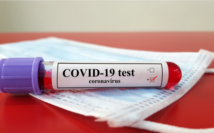 Azərbaycanda son sutkada 19 nəfər koronavirusa yoluxub, ölən olmayıb