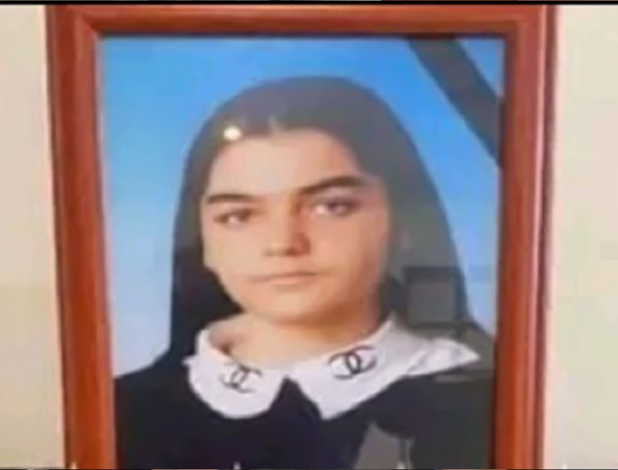 İtin hücumuna məruz qalan 13 yaşlı qız öldü